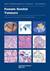 WHO classification of female genital tumours  5th ed., 2020
